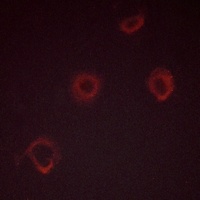 IFNGR1 (Phospho-Y457) Antibody