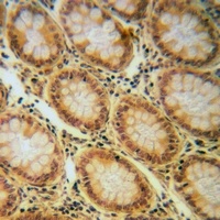 IGF1 Receptor (Phospho-Y1165/Y1166) Antibody