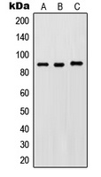 IKK beta (Phospho-Y188) Rabbit Polyclonal Antibody