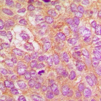 IKK beta (Phospho-Y188) Rabbit Polyclonal Antibody