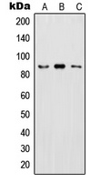 IKK beta (Phospho-Y199) Rabbit Polyclonal Antibody
