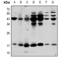 IL-1 beta Rabbit Polyclonal Antibody