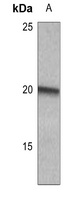 MYL9 (Phospho-S20) Rabbit Polyclonal Antibody