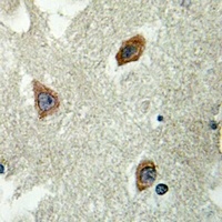 MYL9 (Phospho-S20) Rabbit Polyclonal Antibody