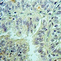 IL-5 Antibody