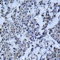 IL-12B Antibody