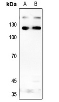 INCENP Rabbit Polyclonal Antibody