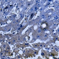 SHIP1 Rabbit Polyclonal Antibody