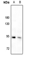 IRAK1 (Phospho-T209) Rabbit Polyclonal Antibody