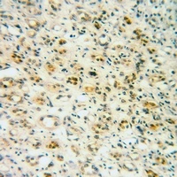 IRAK1 (Phospho-T209) Rabbit Polyclonal Antibody