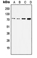 IRAK2 Rabbit Polyclonal Antibody