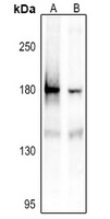 IRS1 (Phospho-S1101) Rabbit Polyclonal Antibody