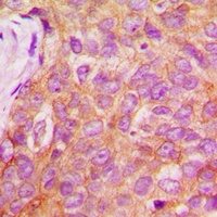 IRS1 (Phospho-S1101) Rabbit Polyclonal Antibody