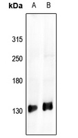 IRS1 Rabbit Polyclonal Antibody