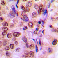 IRS1 Rabbit Polyclonal Antibody