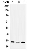 CD49e LC Antibody [KO/KD Validated]