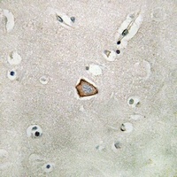 CD51 Rabbit Polyclonal Antibody