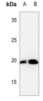 Cofilin (Phospho-S3) Rabbit Polyclonal Antibody