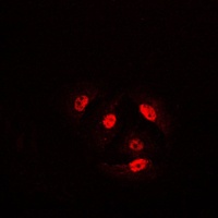 Cofilin (Phospho-S3) Rabbit Polyclonal Antibody