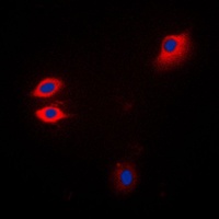 JAK1 Antibody