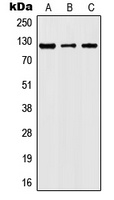 JAK2 (Phospho-Y1007) Rabbit Polyclonal Antibody