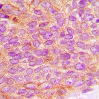 JAK2 (Phospho-Y1007) Rabbit Polyclonal Antibody