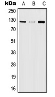 JAK2 (Phospho-Y570) Rabbit Polyclonal Antibody
