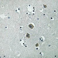 JAK2 (Phospho-Y570) Rabbit Polyclonal Antibody