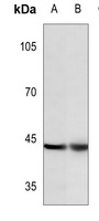 c-Jun (Phospho-Y170) Rabbit Polyclonal Antibody