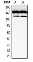 CD117 Antibody