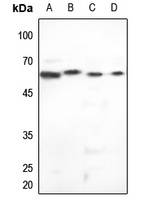 Cytokeratin 5 Rabbit Polyclonal Antibody