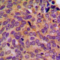 Cytokeratin 5 Rabbit Polyclonal Antibody