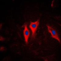 Cytokeratin 5 Rabbit Polyclonal Antibody