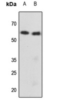 Cytokeratin 8 (Phospho-S73) Rabbit Polyclonal Antibody