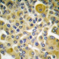 Cytokeratin 8 (Phospho-S73) Rabbit Polyclonal Antibody