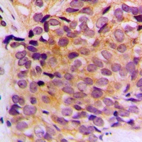 Cytokeratin 10 Rabbit Polyclonal Antibody