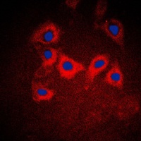 Cytokeratin 10 Rabbit Polyclonal Antibody