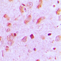Cytokeratin 13 Rabbit Polyclonal Antibody
