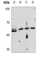 Cytokeratin 16 Rabbit Polyclonal Antibody