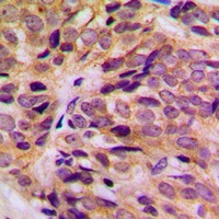 Cytokeratin 16 Rabbit Polyclonal Antibody