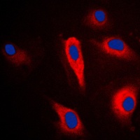 Cytokeratin 16 Rabbit Polyclonal Antibody