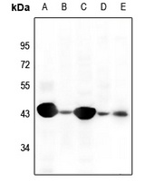 Cytokeratin 19 Rabbit Polyclonal Antibody
