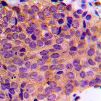 Cytokeratin 19 Rabbit Polyclonal Antibody