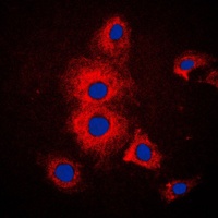 Cytokeratin 19 Rabbit Polyclonal Antibody