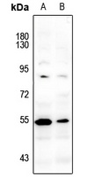 LCK (Phospho-Y393) Rabbit Polyclonal Antibody