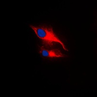 LCK (Phospho-Y393) Rabbit Polyclonal Antibody