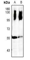 LCK Rabbit Polyclonal Antibody