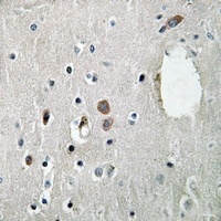 SLP76 (Phospho-Y128) Rabbit Polyclonal Antibody