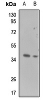 Galectin 9 Antibody