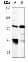 LIMK1 Rabbit Polyclonal Antibody
